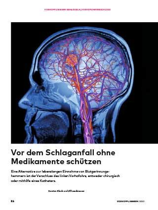 Titelbild des Artikels Vorhofohrverschluss