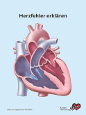 Titelbild des Blocks "Herzfehler erklären"